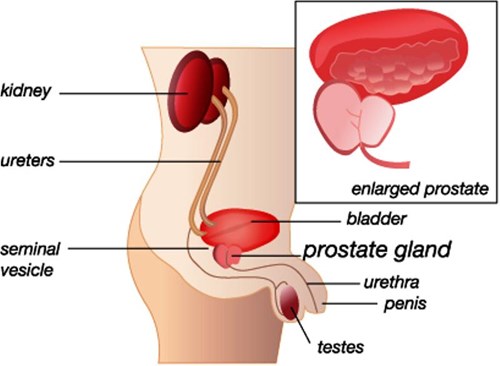 prostate infection symptoms nhs gyógynövények altai prostatitis
