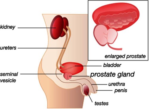 prostate infection symptoms nhs